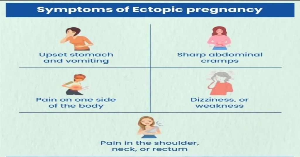 Ectopic pregnancy